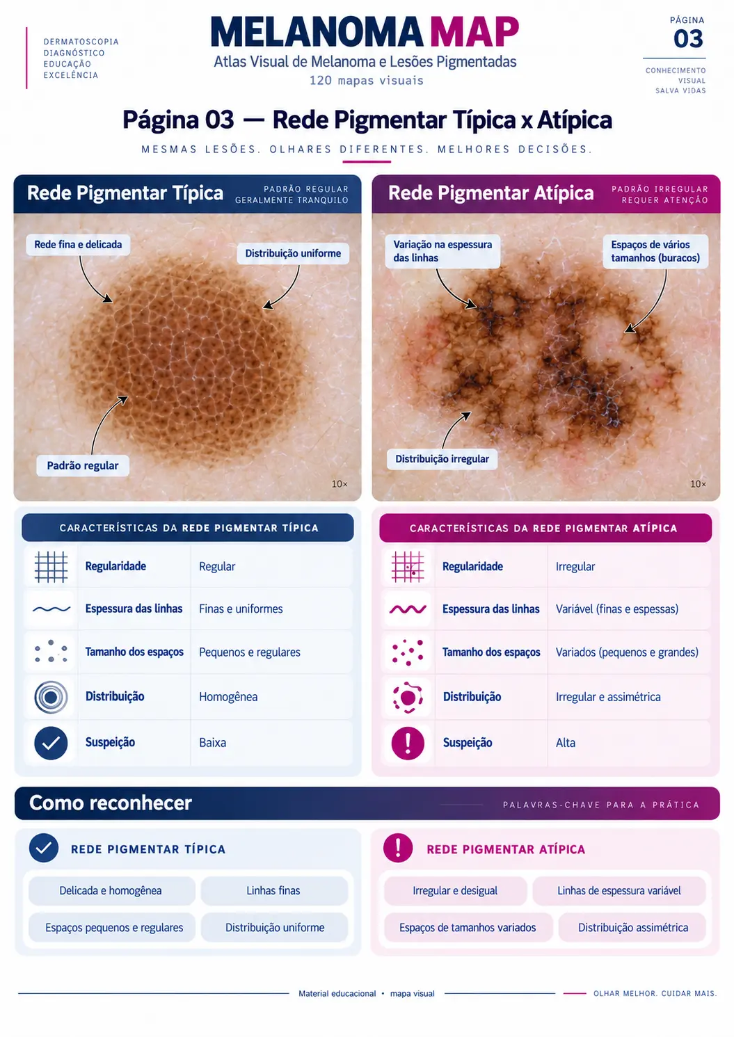 Página do MELANOMA MAP: Rede Pigmentar Típica x Atípica