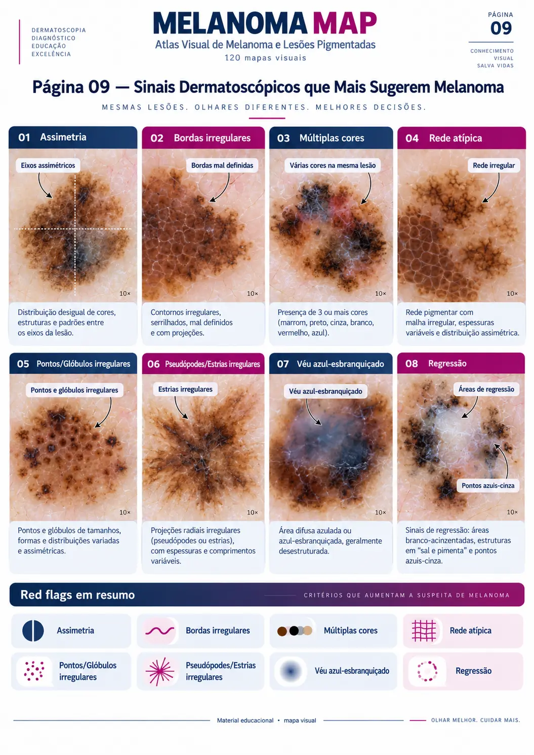 Página do MELANOMA MAP: Sinais Dermatoscópicos que Mais Sugerem Melanoma