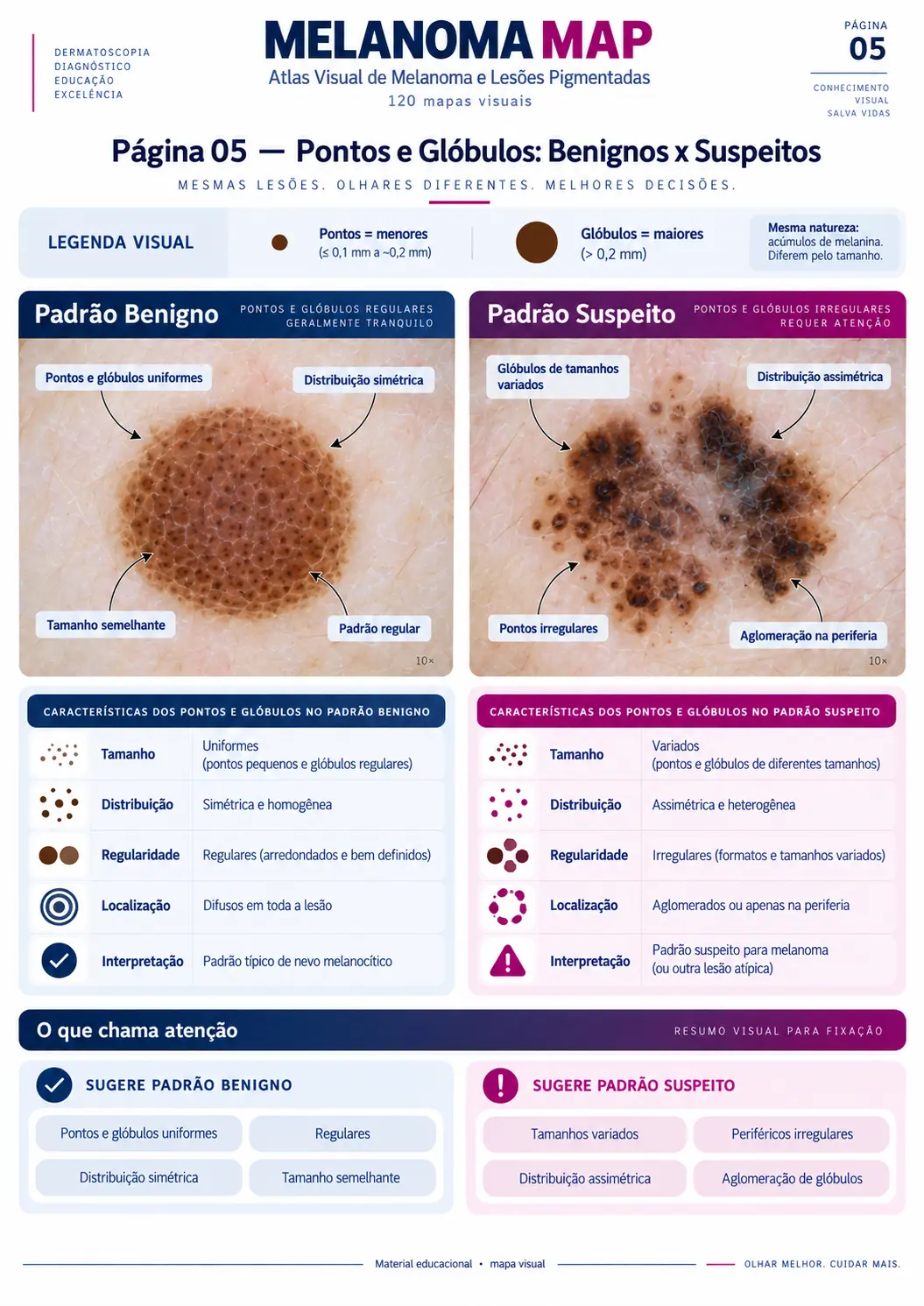 Página do MELANOMA MAP: Pontos e Glóbulos: Benignos x Suspeitos