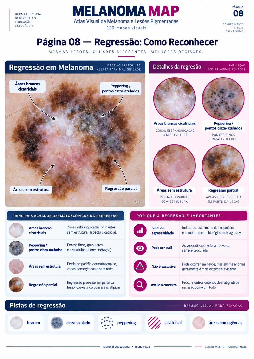 Página do MELANOMA MAP: Regressão: Como Reconhecer