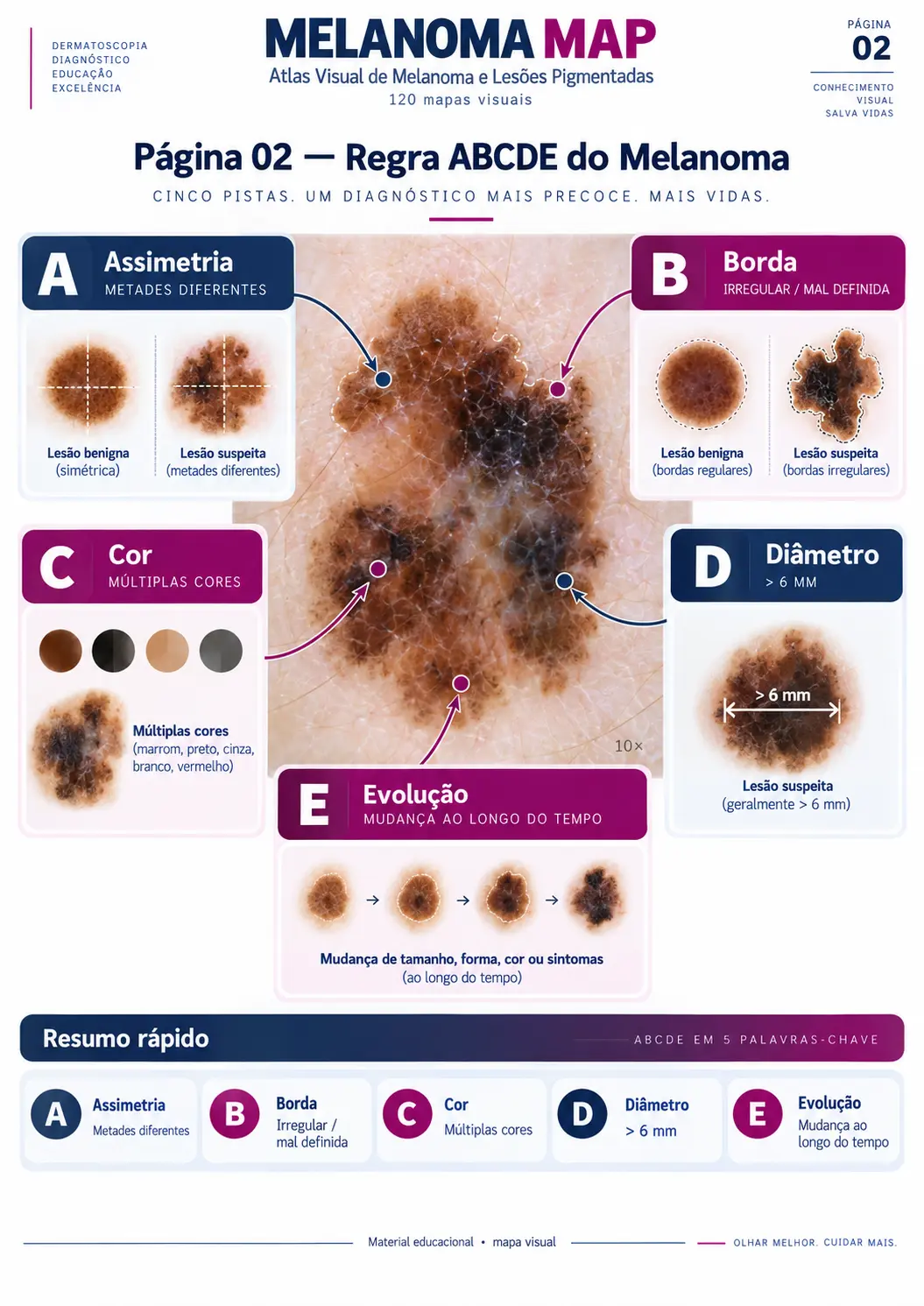 Página do MELANOMA MAP: Regra ABCDE do Melanoma