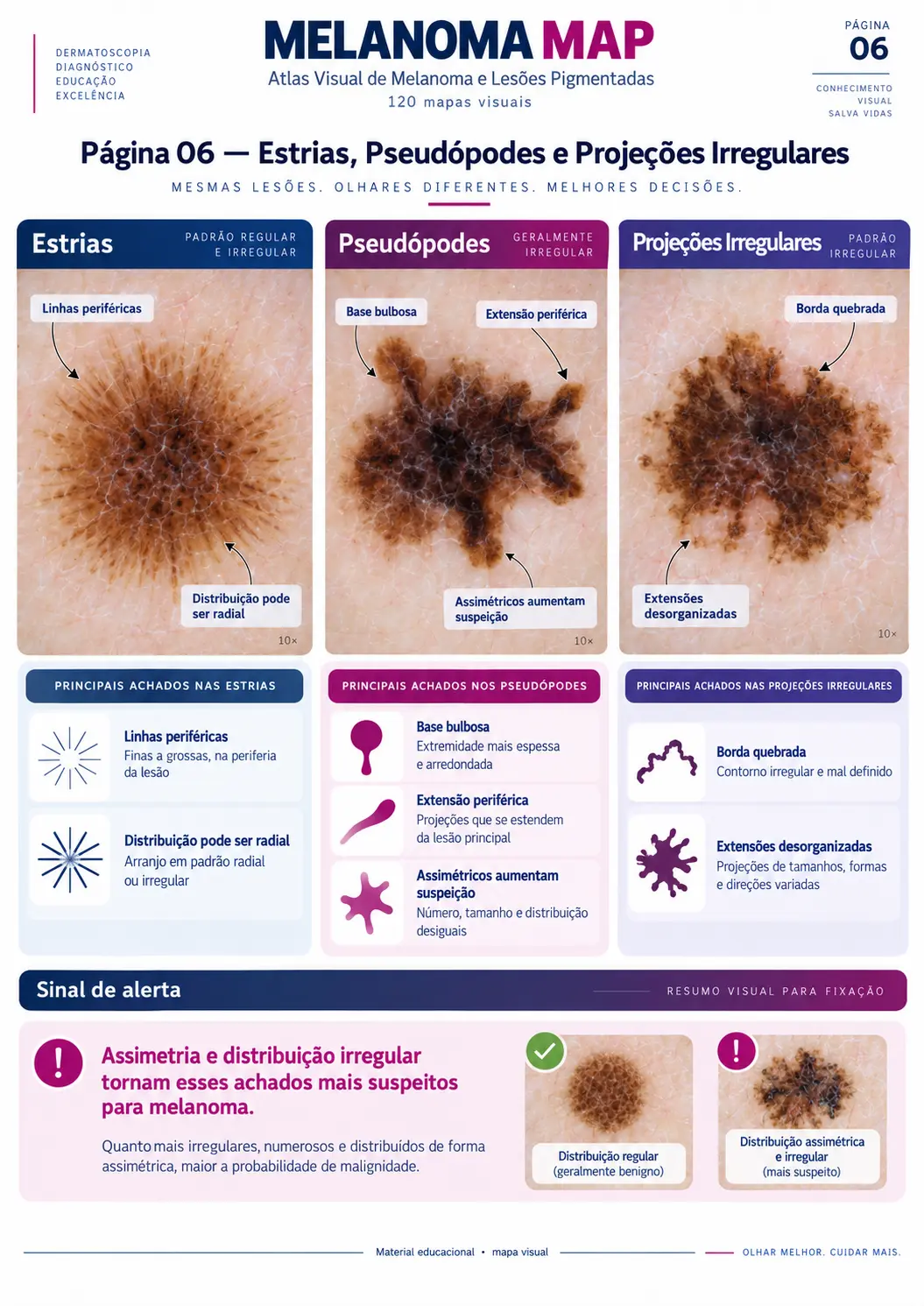 Página do MELANOMA MAP: Estrias, Pseudópodes e Projeções Irregulares